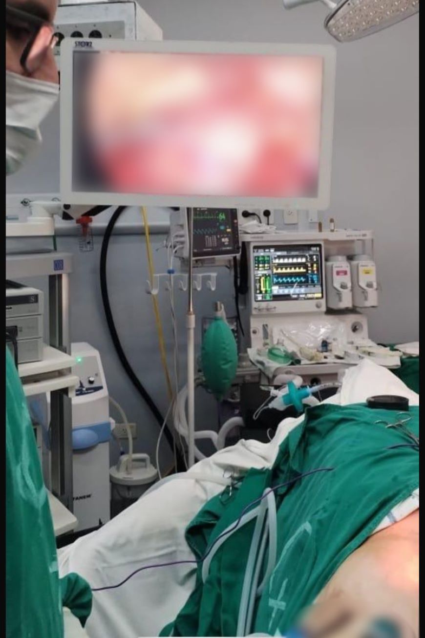 Profesionales del INCAN realizan cirugía videoendoscópica para el tratamiento del cáncer de pene